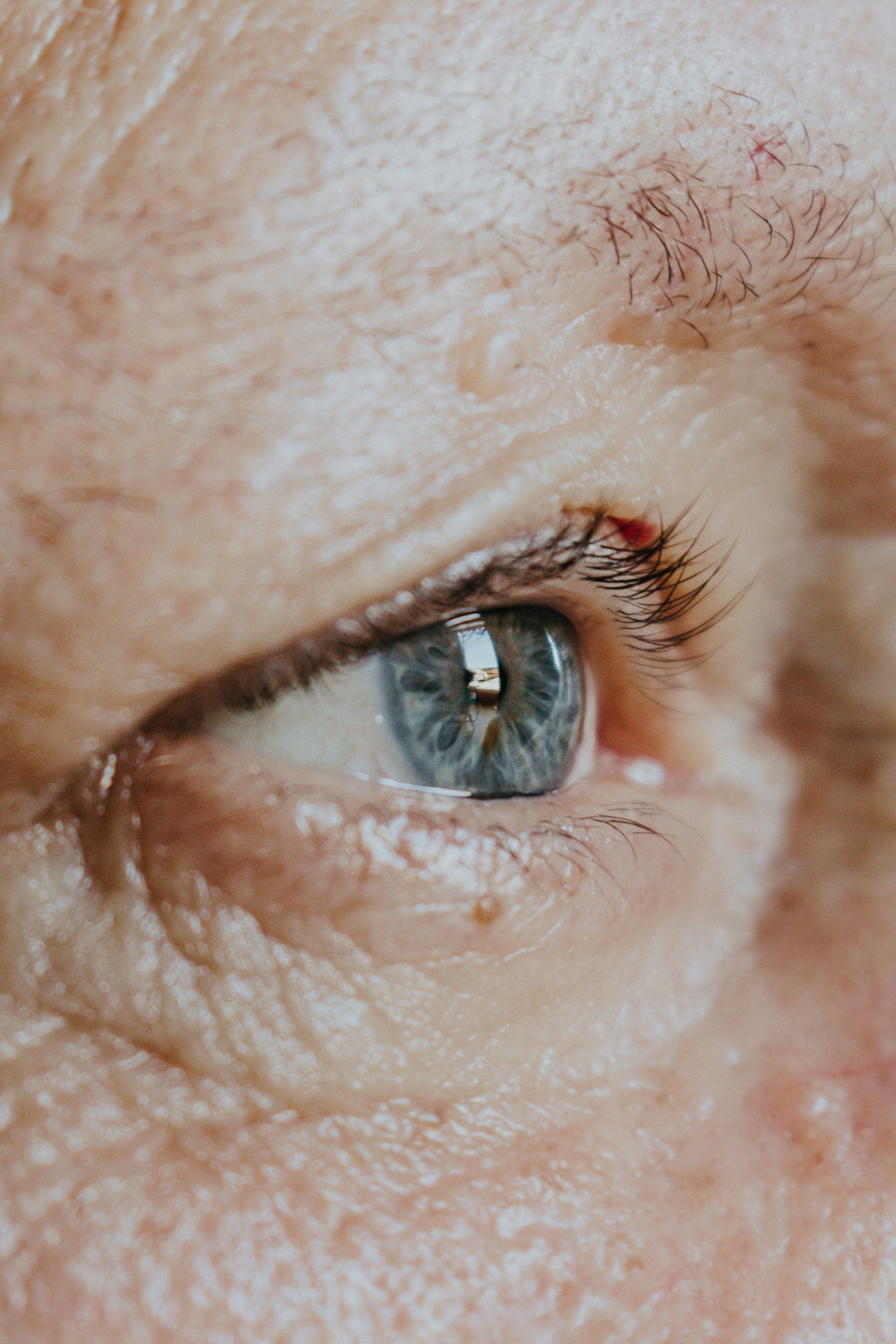 possible cataract candidate